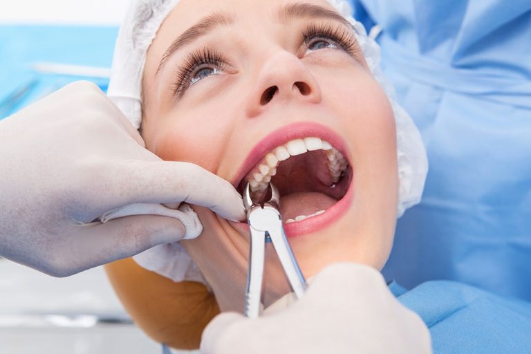 چه دندان هایی ممکن است در درمان ارتودنسی کشیده شوند؟