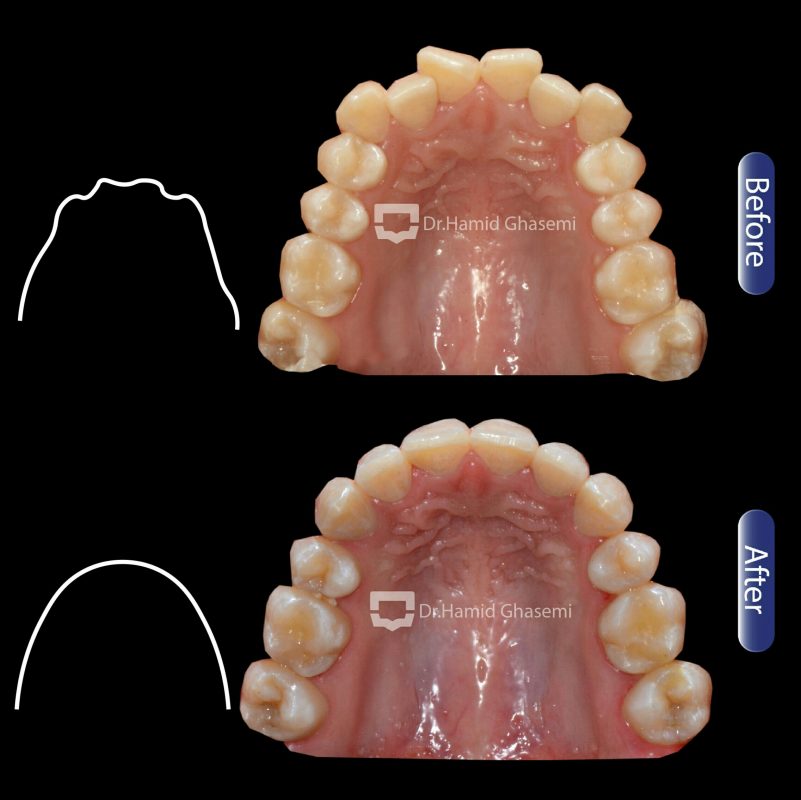درمان ارتودنسی دندان