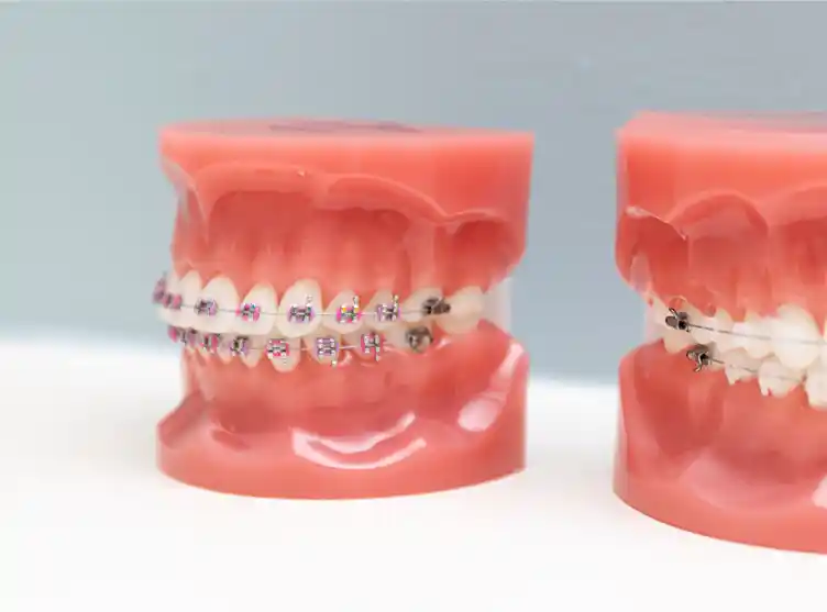 چه کسانی نیازمند ارتودنسی هستند