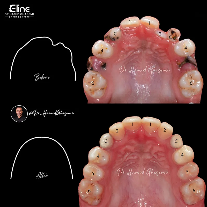 معاینه و بررسی وضعیت رشد دندان‌ها و فک کودکان در مطب دکتر حمید قاسمی متخصص ارتودنسی در تهران