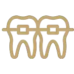 ارتودنسی ثابت با براکت‌های مدرن