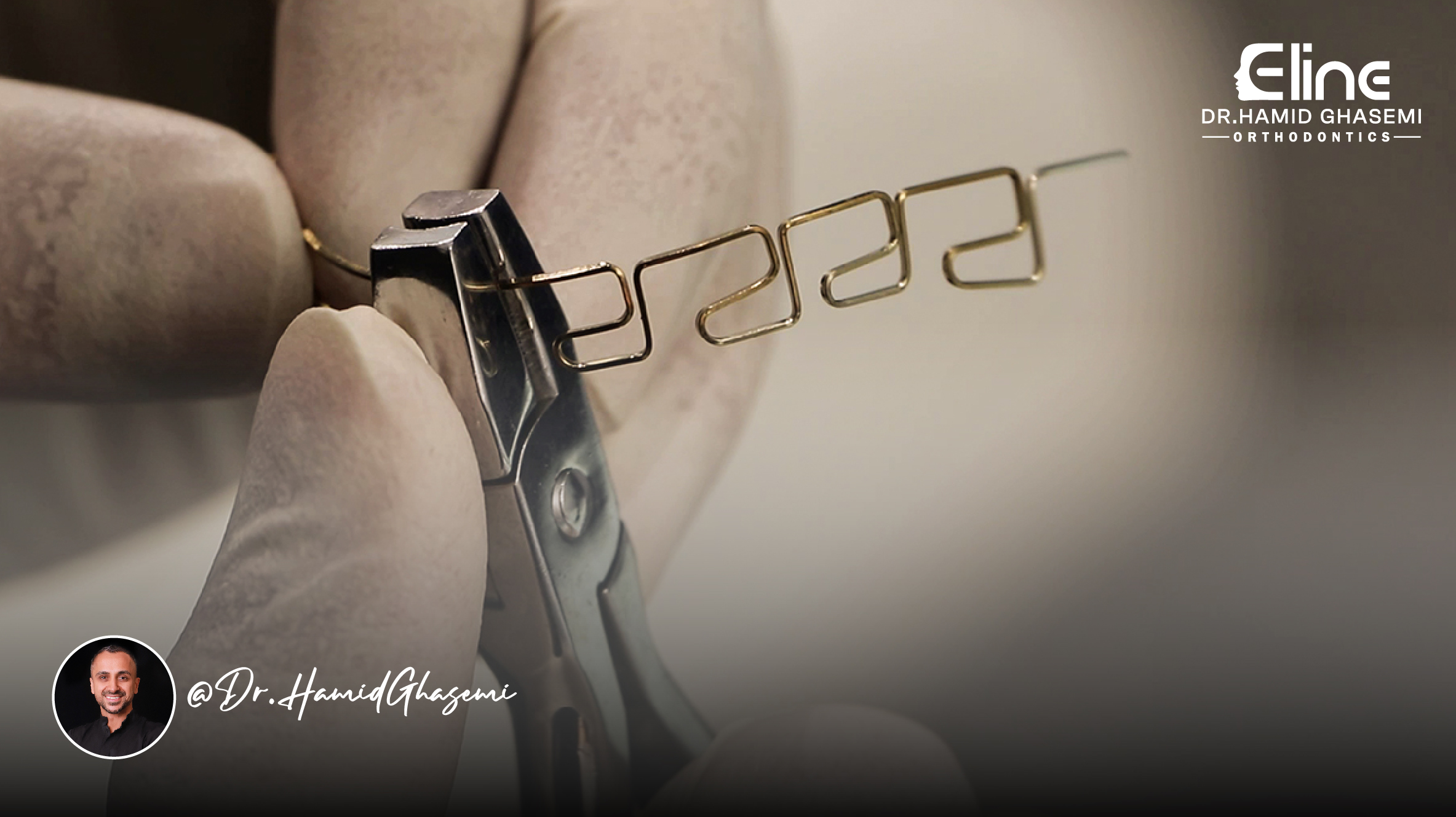 درمان ارتودنسی با روش MEAW تحت نظر متخصص ارتودنسی